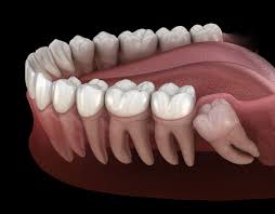 HOW MANY TYPE OF TEETH