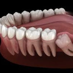 HOW MANY TYPE OF TEETH 